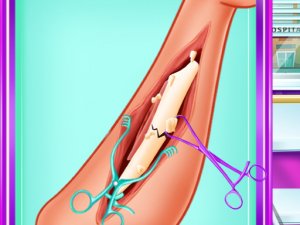 Ladybug Leg Surgery Online Game - Kids Care Game